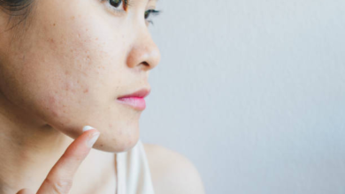 retinoids