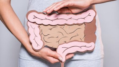 Colonic