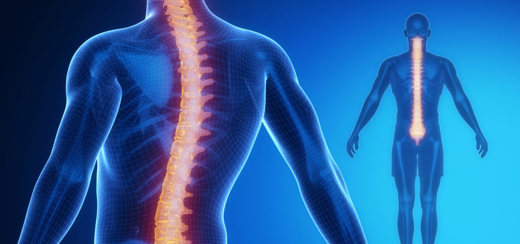 scoliosis specialist in Melbourne