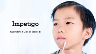 IMPETIGO SORES
