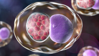 Chlamydia