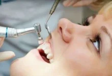Dental Checkup