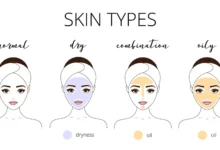 Skin Type