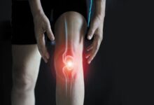 Knee Pain