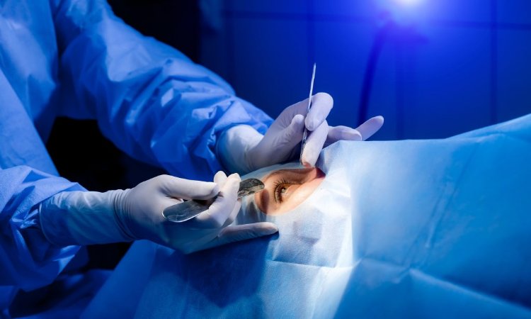 Cataract Surgery