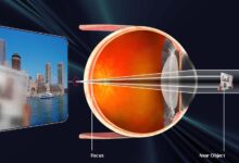 Vision Becomes Presbyopic