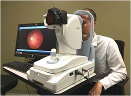 Fundus Camera