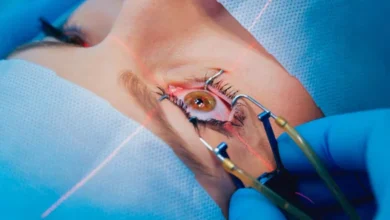 Vision Correction Surgery