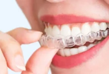 Affordable Retainer Online