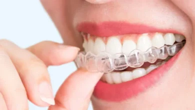 Affordable Retainer Online