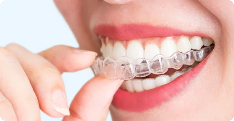 Affordable Retainer Online