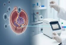 HBV DNA PCR Quantitative Monitoring