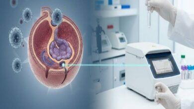 HBV DNA PCR Quantitative Monitoring