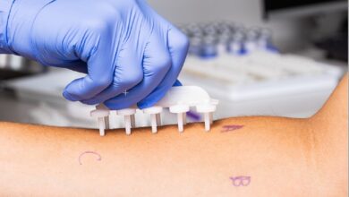 Allergy Test