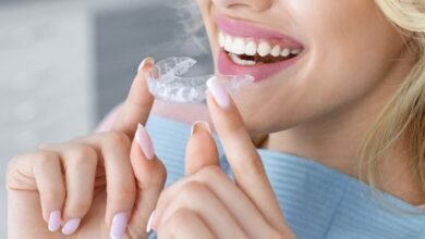 Clear Aligners