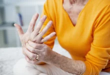 Osteoarthritis